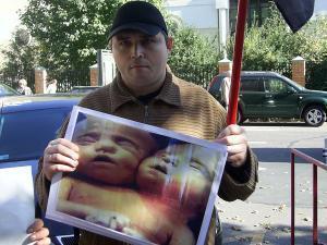 Участник пикета держит фотографию последствий радиационного облучения, 26 сентября 2007 г., Москва