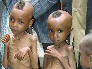 Гоолодающие дети Эфиопии в 1980-е годы не дождались помощи