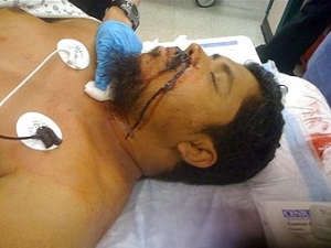 Шариф Ахмед получил несколько ударов ножом только за то, что он мусульманин