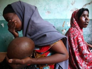 Сомали страдает от сильнейшей засухи, приведший к гуманитарной катастрофе в сфере здравоохранения и продовольствия