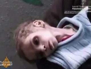 Изможденный палестинский мальчик из лагеря Ярмук