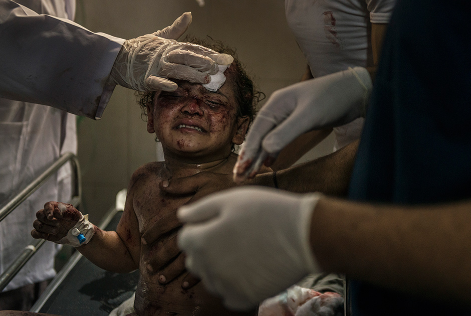 Раненная девочка в госпитале Аш-Шифа в Газе