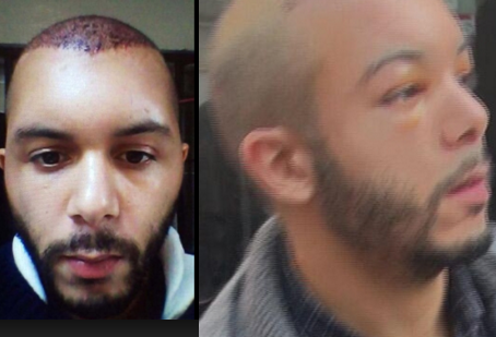 М. Саид все-таки успел пересадить волосы (см. результат слева)