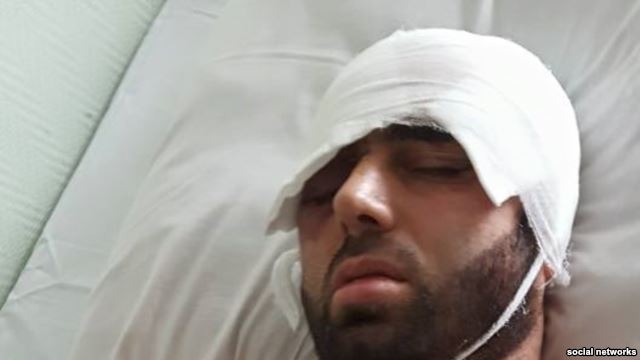 Раненный гражданин Таджикистана лишился одного глаза