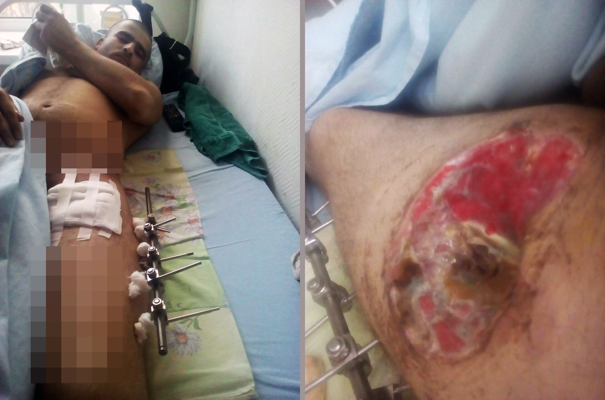 Гражданин Таджикистана получил тяжелые ранения