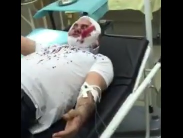 Уроженец Дагестана Магомед Исаев получил глубокое ранение лица и множественные укусы