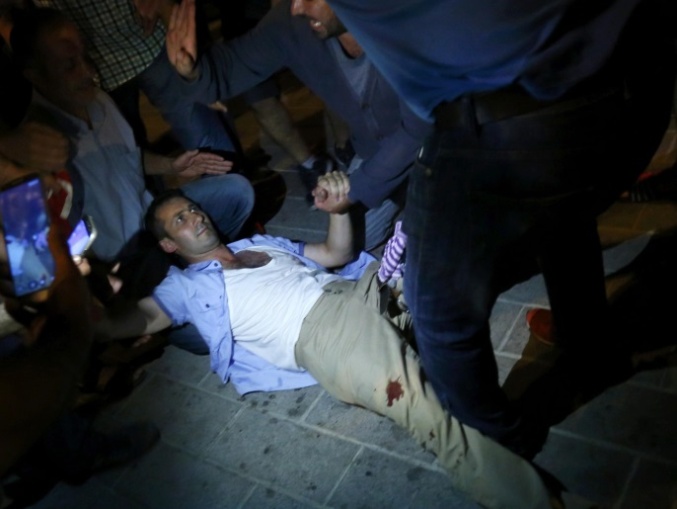 Раненый турок во время военного переворота в Турции