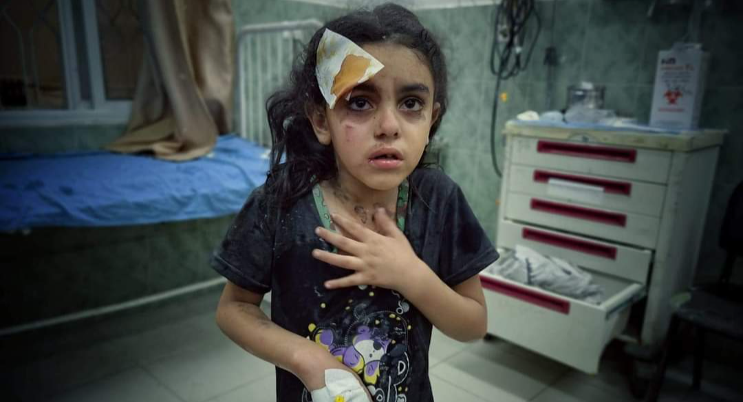 Раненная палестинская девочка
